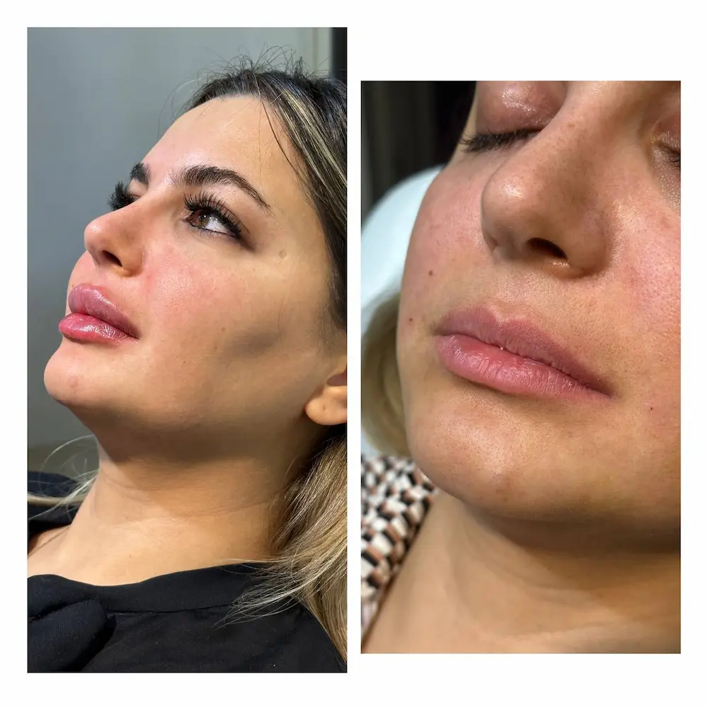 بنر
